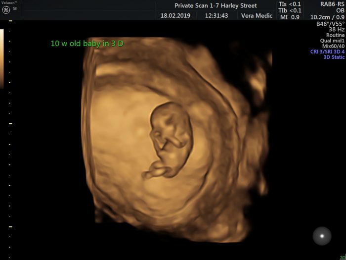 Early Pregnancy Scan | Private Ultrasound Scans London