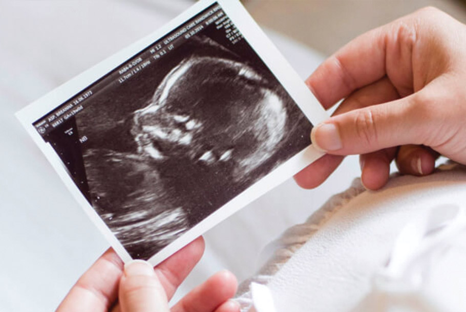 wellbeing-baby-growth-scan-private-ultrasound-scans-london