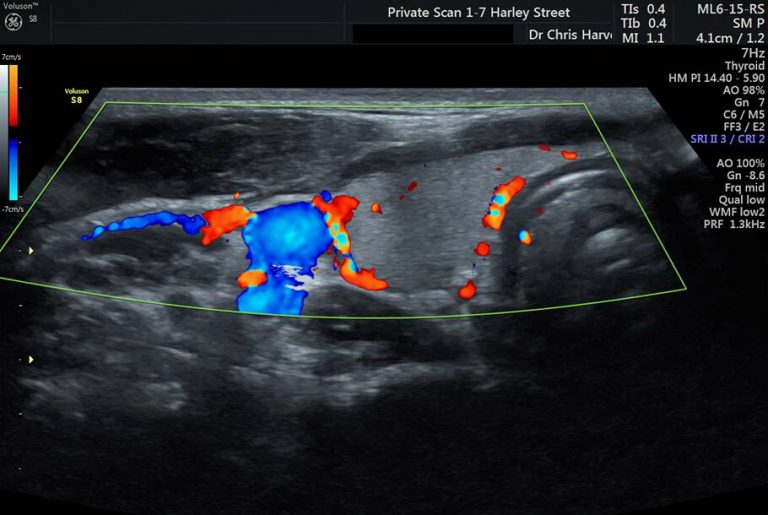 Private Ultrasound Scans London Neck Clinic Scan
